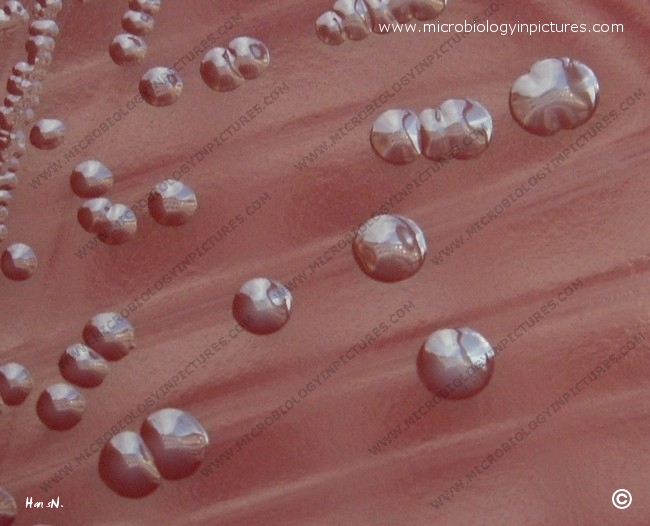 encapsulated S.pneumoniae colony morphology in S-phase